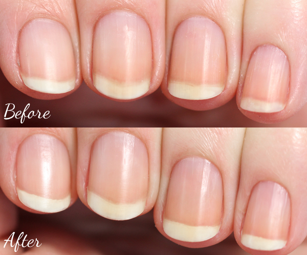 Naked Nails - Before & After via @alllacqueredup