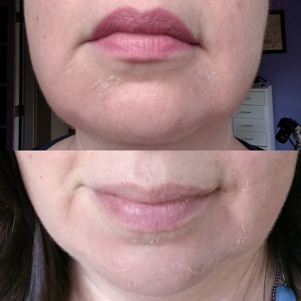 SkinMedica Vitalize Peel - Peeling